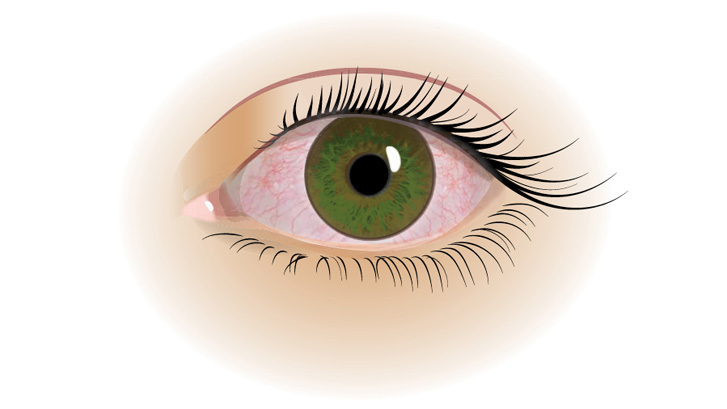 Tørre øjne er ofte trætte, irriterede og løber i vand.