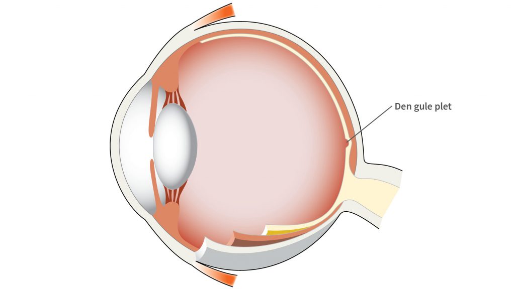 Den gule plet (makula) er det område på nethinden, hvor der er ekstra mange synsceller, og det er det punkt, hvor du ser skarpest.